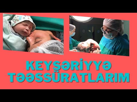 Video: Keyster nəyə istinad edir?