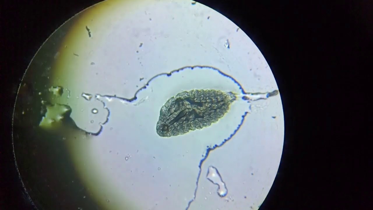 Oestrus ovis larva under microscope