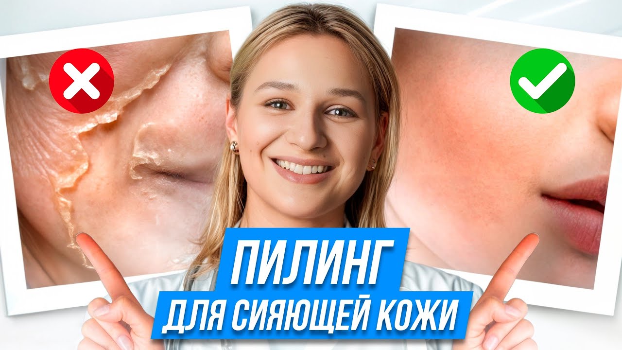 ВСЁ О ПИЛИНГЕ ДЖЕССНЕРА! / Как ИЗБАВИТЬСЯ от постакне и сделать кожу гладкой!