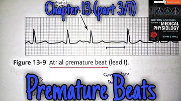Premature contractions - chapter 13 (part 3/7) - Guyton and Hall text book of physiology.
