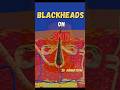 The Real Reason Behind Blackheads ll 3d Animation ll #shorts #animation