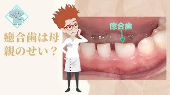 乳歯 Youtube
