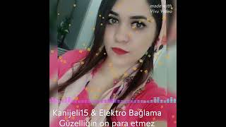 Elektro Bağlamalı Damar Türkü...