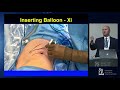 Retroperitoneal Partial Nephrectomy presented by James Porter, MD