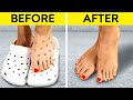 Incredible Shoe Hacks To Avoid Awkward Moments || Shoe Tips, Upgrade, Cleaning