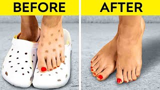 Incredible Shoe Hacks To Avoid Awkward Moments || Shoe Tips, Upgrade, Cleaning