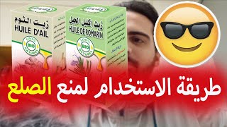 كيفية استخدام زيت الثوم الذكري و زيت اكليل الجبل لمنع تساقط الشعر