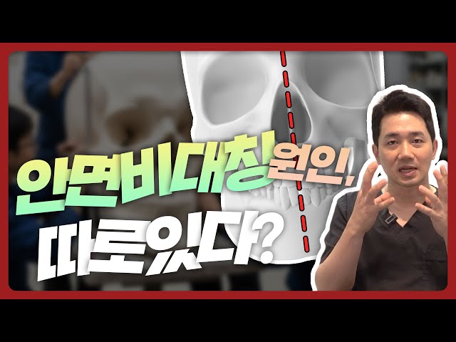 안면비대칭, 왜 생길까? 교정이 필요한 기준과 윤곽수술의 한계ㅣ비티성형외과