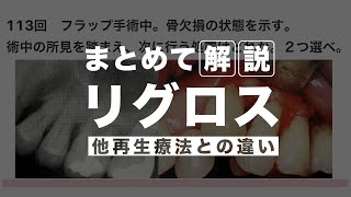 まとめて解説｜リグロスについて