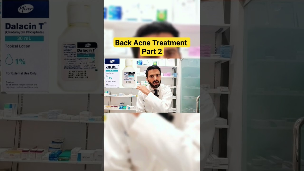 Back Acne Treatment Part 2 
