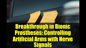 Breakthrough in Bionic Prostheses: Controlling Artificial Arms with Nerve Signals
