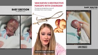 The TRUTH About Abortion...