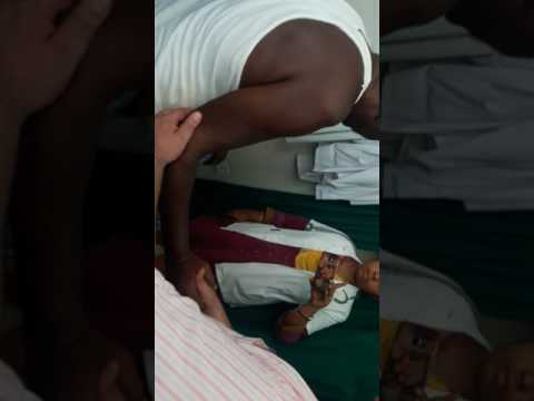 Reduction of anterior dislocation of shoulder in opd by Dr L Prakash method...its magical