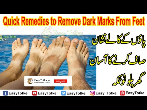 How to Remove Dark Spots from Feet | Paon Saaf Karne ka Tarika | Paon ke Kale Nishan Saaf Karne