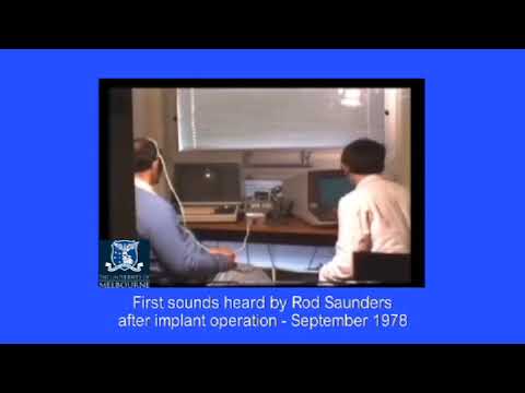 The Story of the First Ever Cochlear Implant in Australia