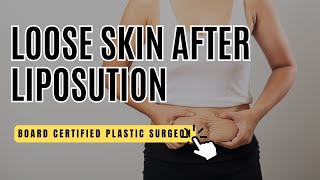 Loose skin after liposuction?