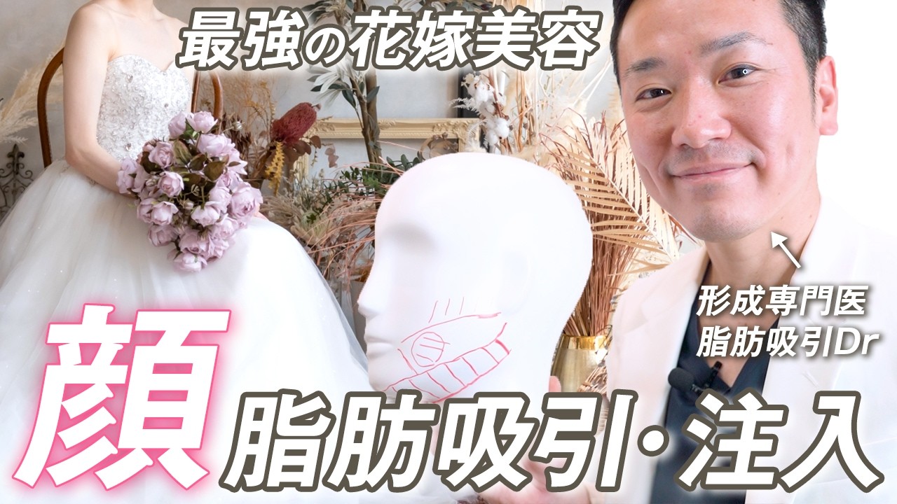 【花嫁美容】結婚式に向けた、おすすめの脂肪吸引・注入を徹底解説します！結婚式で映える、ちゅるんとした卵型フェイスを手に入れるのは？最後のお得な情報も！【モッズクリニック】
