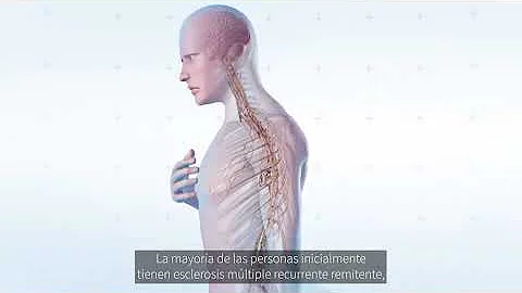 ¿Qué enfermedades imitan a la esclerosis múltiple?