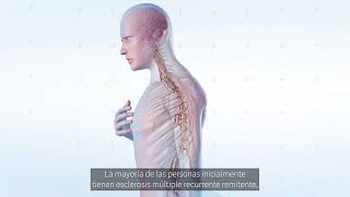 ¿Qué es la esclerosis múltiple? Síntomas, tratamientos e investigación de la enfermedad