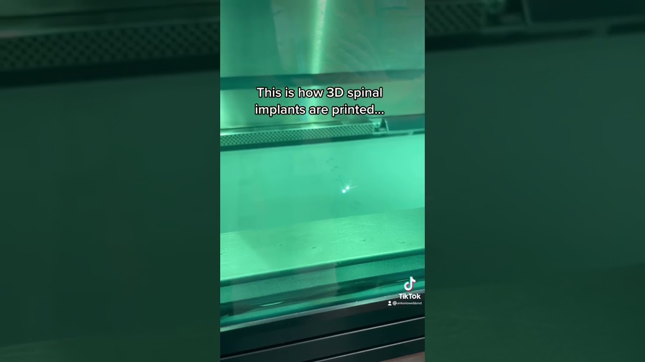This is how 3D Spinal Implants are Printed..