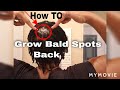 NATURAL HAIR | #HOW TO GROW YOUR EDGES + BALD SPOTS | Update!