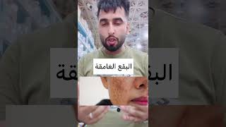 حل مشاكل البشرة مع أفضل  السيرومات