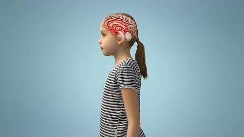 How Immune Response to Strep Infection Triggers BGE Breakdown of Blood Brain Barrier PANDAS/PANS