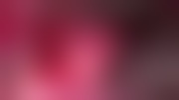 Trigeminal Neuralgia--microvascular decompression (petrosal vein)