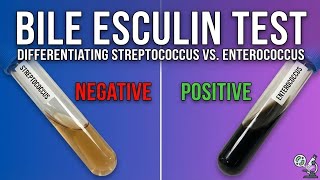 bile esculin test positive reaction #education #health #microbiology 