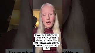 Who will love me if I look like this  lonelygirl albino datingover50.mp4