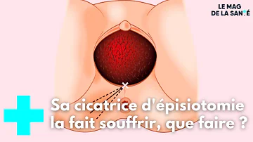 Comment cicatriser après une épisiotomie ?