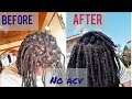 BAKING SODA AND WATER (ONLY) Deep cleaning wash | Remove build up! | Hair transformation