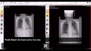 OsiriX :: manual fusion of two series
