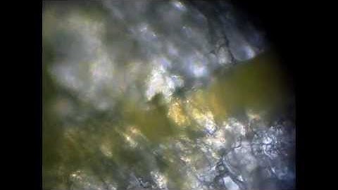 Physarum polycephalum cytoplasmic streaming (speeded up to show direction change)