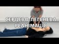 Серцево-легенева реанімація