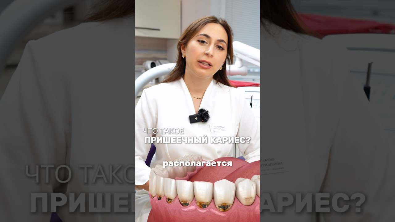 САМЫЙ ОПАСНЫЙ ВИД КАРИЕСА! Почему он образуется? Как избежать появление и его развитие?