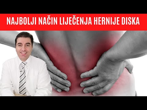 Najbrži način liječenja DISKUS HERNIJE, PROTRUZIJE I BULGINGA diska kralježnice!