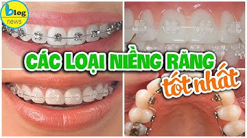 Phương pháp niềng răng nào phù hợp với bạn nhất?
