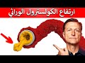 أفضل طريقة طبيعية لخفض الكولسترول الوراثي العائلي 