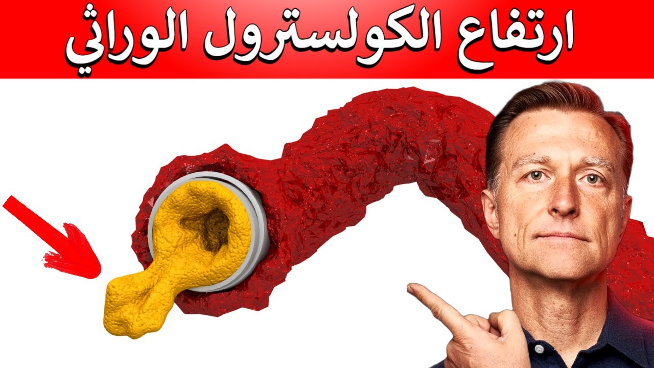 أفضل طريقة طبيعية لخفض الكولسترول الوراثي (العائلي)