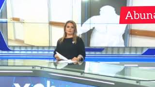 Son Xeber Azərbaycan Tibb Universitetinin Tədris Cərrahiyyə Klinikasının 33 Həkimi Koronavirus