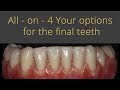 Options for full set of implants