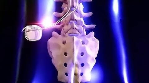 Current & Future of Epidural Stimulation Clinical Trials in U.S. For Spinal Cord Injury - 9/30/2020