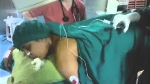 suprascapular nerve block posterior approach by Ashok Jadon