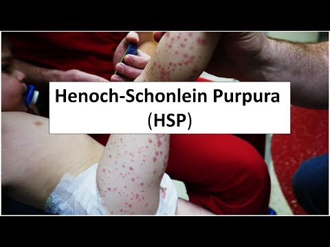 Henoch-Schonlein Purpura (HSP)