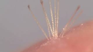 Removing cactus needles