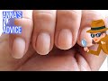 Soft & Peeling Nails, WHY?! [ANNA'S NAIL ADVICE]