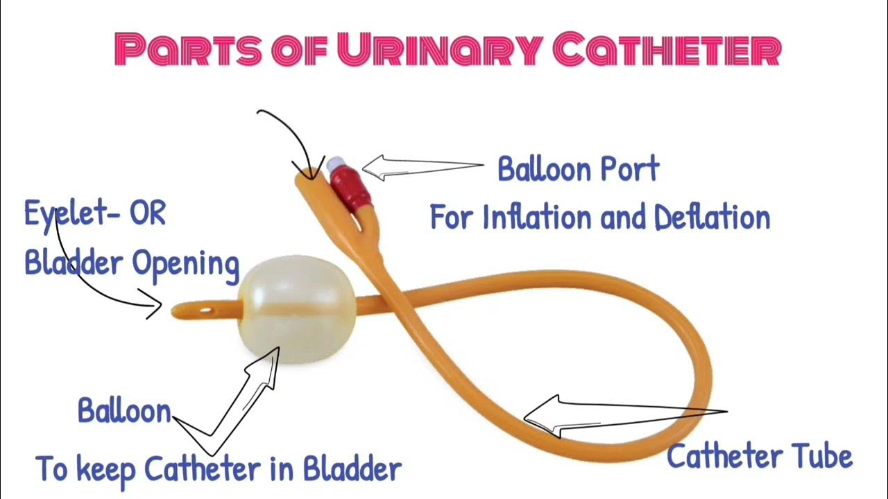 Urinary Catheter Definition + Types + Parts + Uses / Short Answer