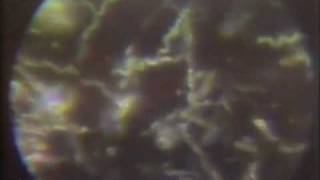 Spirochetes through the microscope