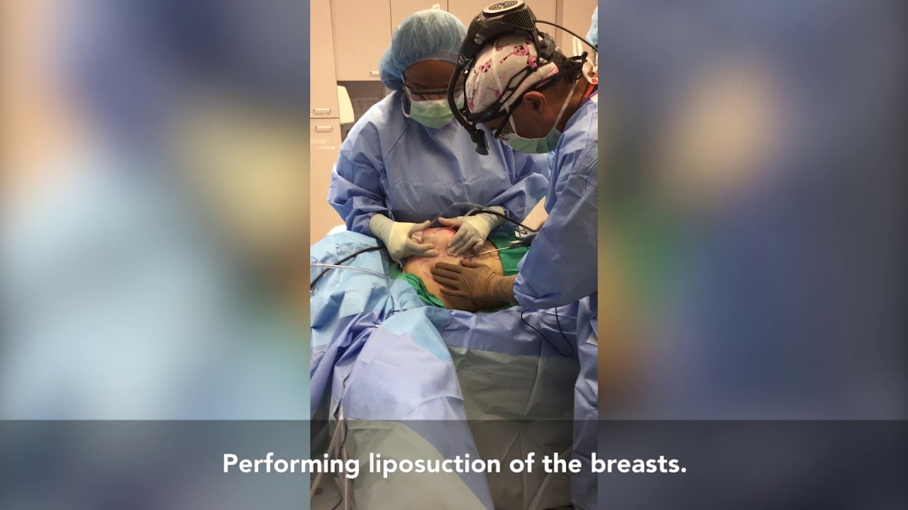 Revision Breast Augmentation & Revision Tummy Tuck by Dr. Pousti YouTube Revision Breast Augmentation & Revision Tummy Tuck by Dr. Pousti YouTube